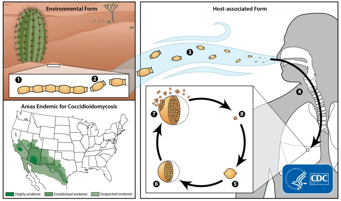 cocci or valley fever informational poster